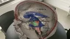 AnatomyX screenshot 1