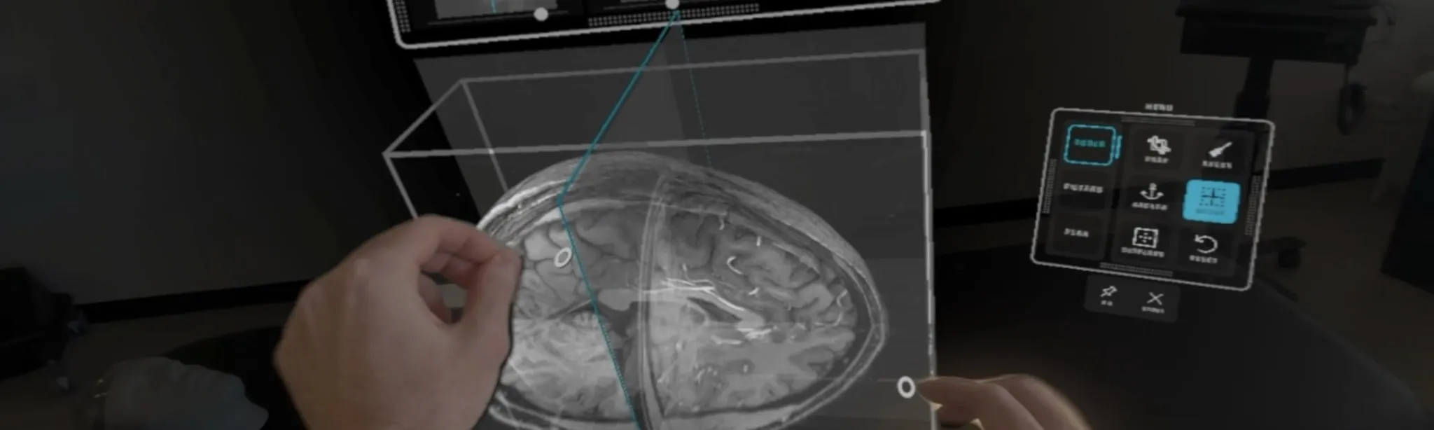 SurgicalAR Viewer