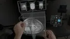 SurgicalAR Viewer screenshot 3