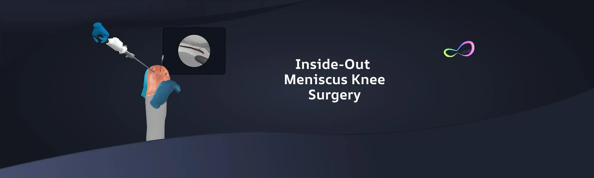 Meniscus Repair Inside Out