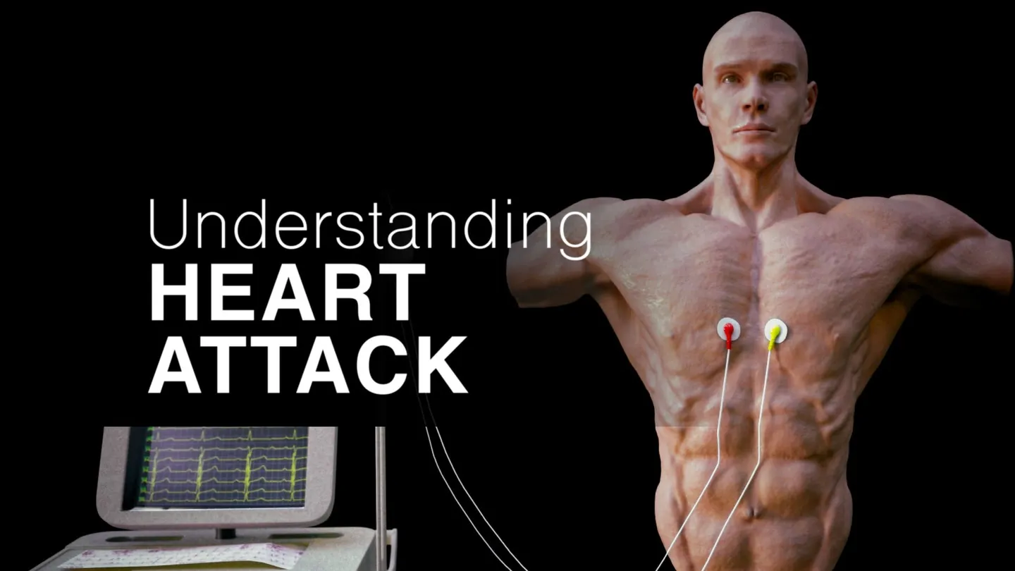 Understanding Heart Attack trailer 0