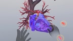 Understanding Heart Attack screenshot 3