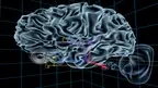 UW Virtual Brain Project screenshot 3