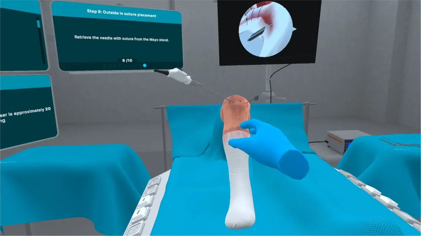 Bucket Handle Meniscus Tear Surgery cover image