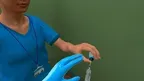 Knee Arthrocentesis screenshot 4