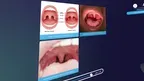 VOMA Speech Pathology screenshot 2
