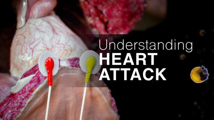 Developer update image for Immerse Yourself in the Heart: Understand Heart Attacks