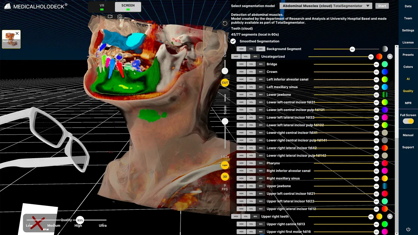 Medicalholodeck – Anatomy, Imaging & AI trailer 0