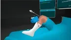 Meniscus Repair Outside In screenshot 4