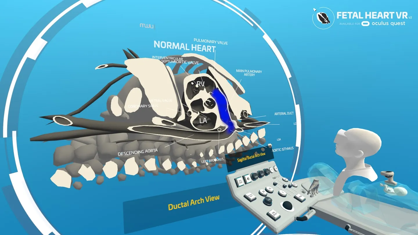 Fetal Heart VR trailer 0