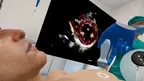Echocardiography VR - VML screenshot 4
