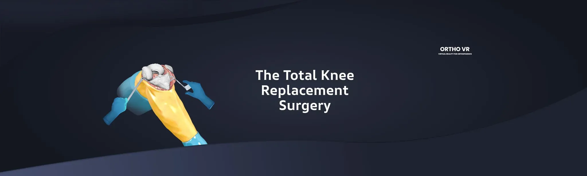 Total Knee Replacement Surgery