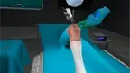 All Inside Meniscus Repair Surgery screenshot 2