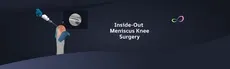 Meniscus Repair Inside Out hero image