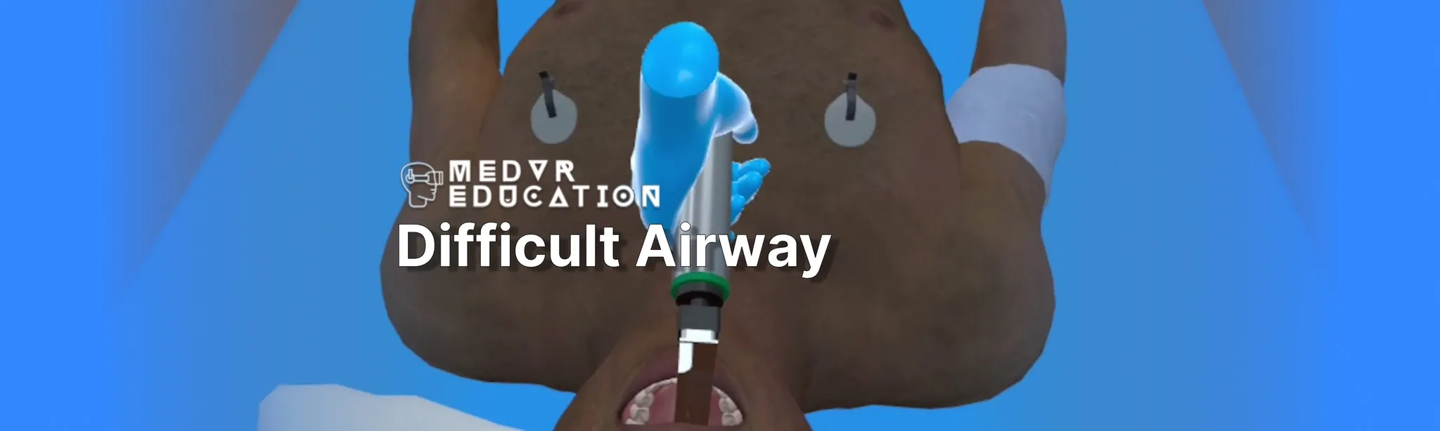 Difficult Airway