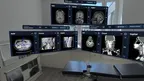 HoloMedicine® Patient Viewer screenshot 1