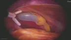 SurgicaVR screenshot 3