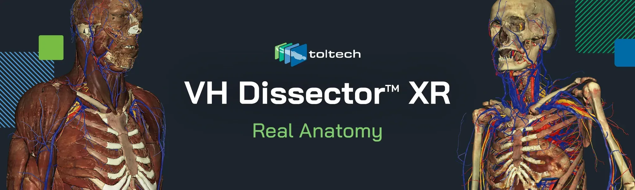 VH Dissector XR - Price History and Deals
