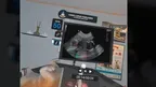 Dog Ultrasound screenshot 3