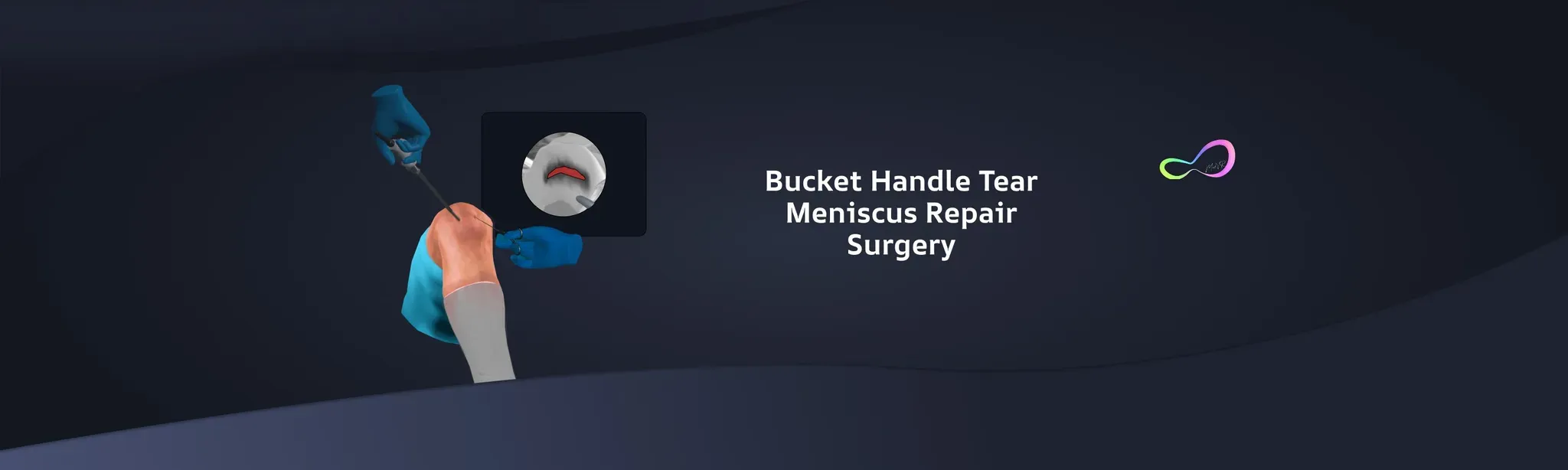 Bucket Handle Meniscus Tear Surgery
