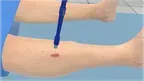 Viscer Medical II screenshot 5