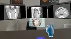 HoloDentist screenshot 1
