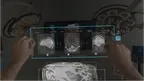 SurgicalAR Viewer screenshot 4