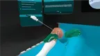 Meniscus Repair Inside Out screenshot 1