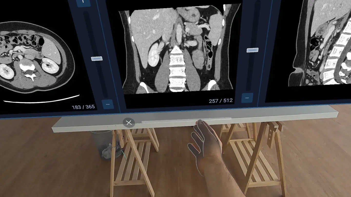 HoloMedicine® Patient Viewer cover image