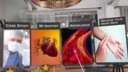 Understanding Heart Attack in Women  - Sit and Learn screenshot 1