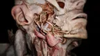 Medicalholodeck – Anatomy, Imaging & AI screenshot 2