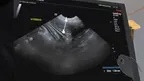 Dog Ultrasound screenshot 2