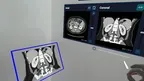 HoloMedicine® Patient Viewer screenshot 2