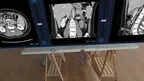 HoloMedicine® Patient Viewer screenshot 0