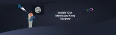 Meniscus Repair Inside Out hero image