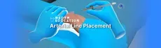 Arterial Line Placement hero image