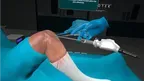 All Inside Meniscus Repair Surgery screenshot 4