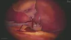 SurgicaVR screenshot 5