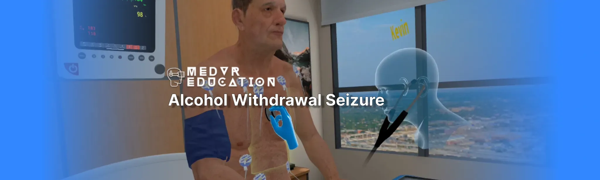 Alcohol Withdrawal Seizure