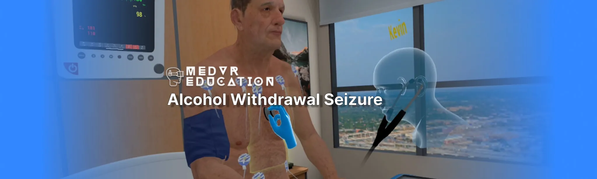 Alcohol Withdrawal Seizure